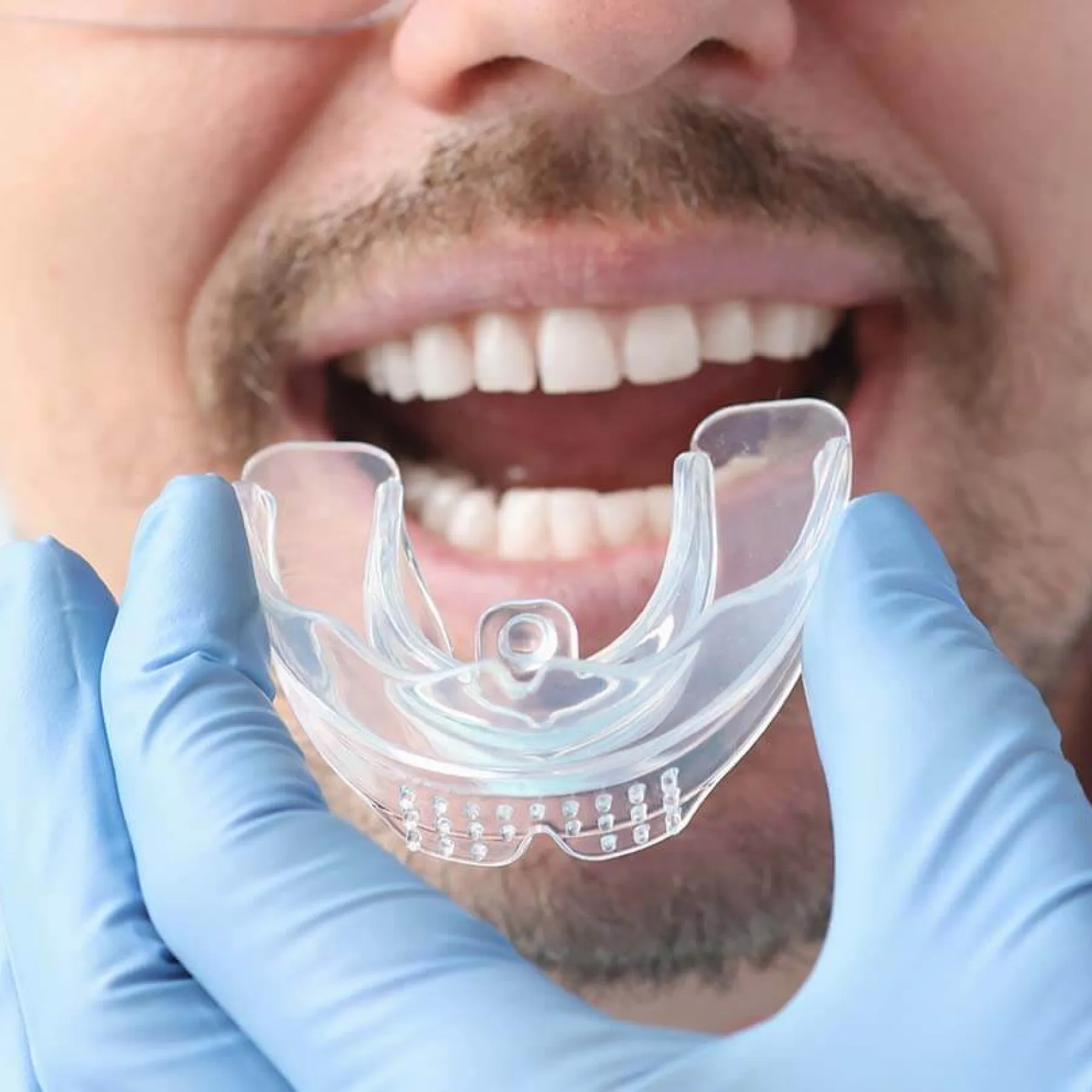Fisher Dental | Mouthguards